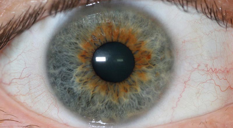 Nahaufnahme der Iris zur Augendiagnose